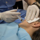 mesoterapia facial